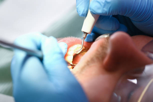 Best Emergency Broken Tooth Repair in Springfield, CO